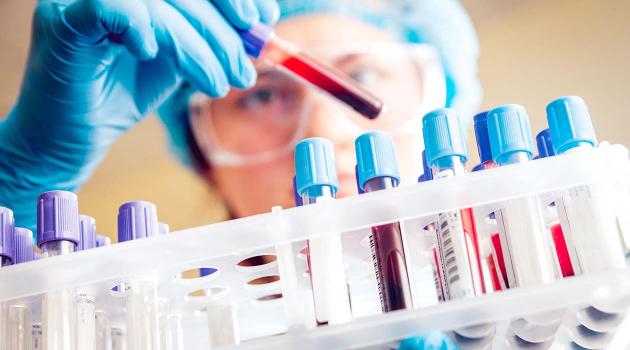 EL ROL DEL CONTROL DE CALIDAD EN EL ACCESO DE LA INDUSTRIA AVÍCOLA COLOMBIANA A MERCADOS INTERNACIONALES