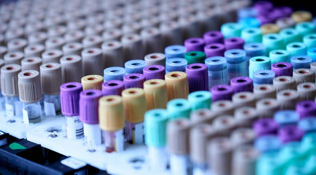 El Papel de los Análisis Fisicoquimícos en la calidad de la industria avicola